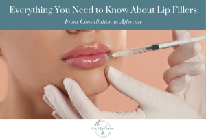 Everything You Need to Know About Lip Fillers: From Consultation to Aftercare