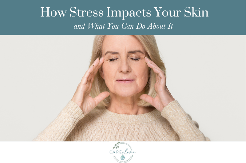 How Stress Impacts Your Skin and What You Can Do About It